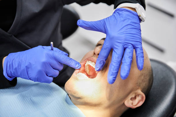 Best Emergency Dental Care for Broken or Chipped Teeth in Nora Springs, IA